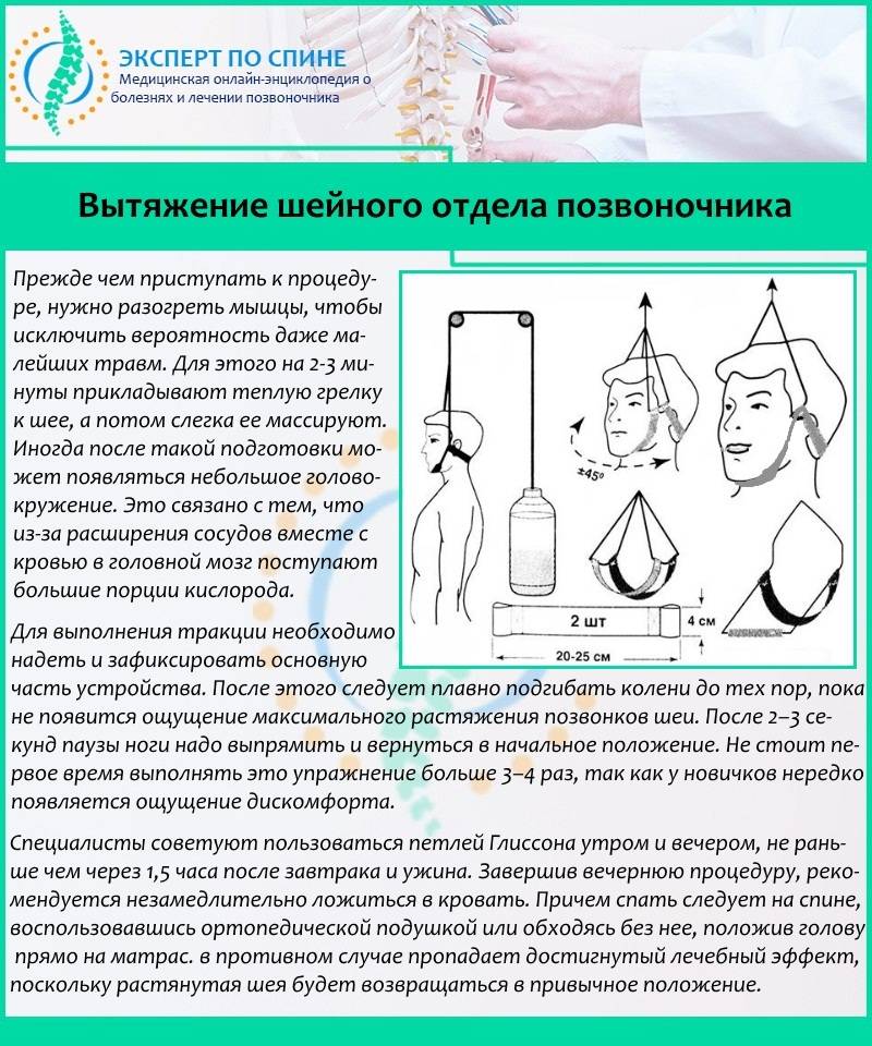 Лучшие модели петель глиссона на 2021 год