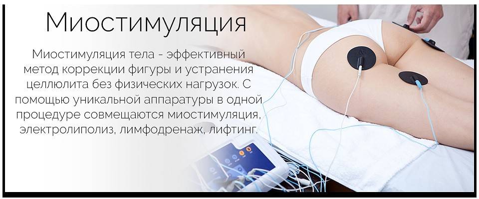 Лучшие миостимуляторы